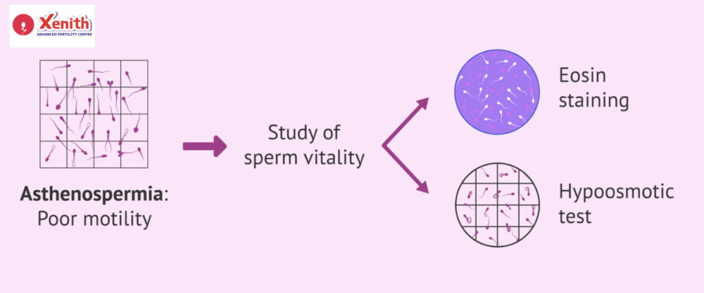 How Is Low Sperm Motility Diagnosed?
